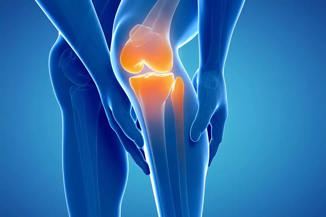 Knee joint disease (knee joint disease, osteoarthritis deformity)