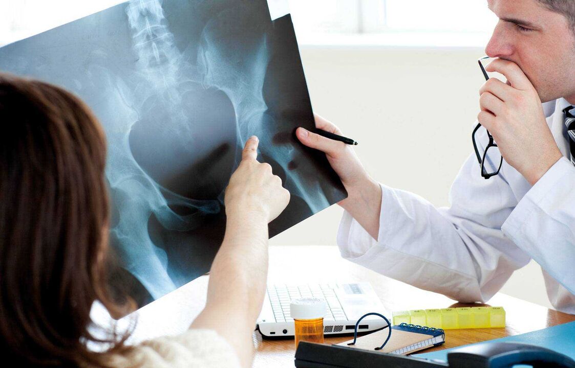 Doctor examining x-ray of hip joint